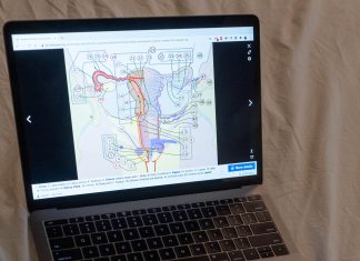 Día Mundial de la Endometriosis, ¿cuánto sabemos realmente sobre ello?