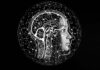 El auge de la Inteligencia Artificial: sesgos y discriminación